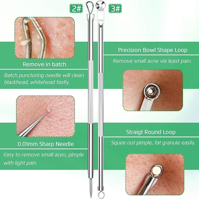 5PCS Blackhead Remover Comedone Extractor, Curved Blackhead Tweezers Kit - Image 4