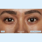 NuFACE IonPlex Hydra-Gel Power Under Eye Patches - Image 5