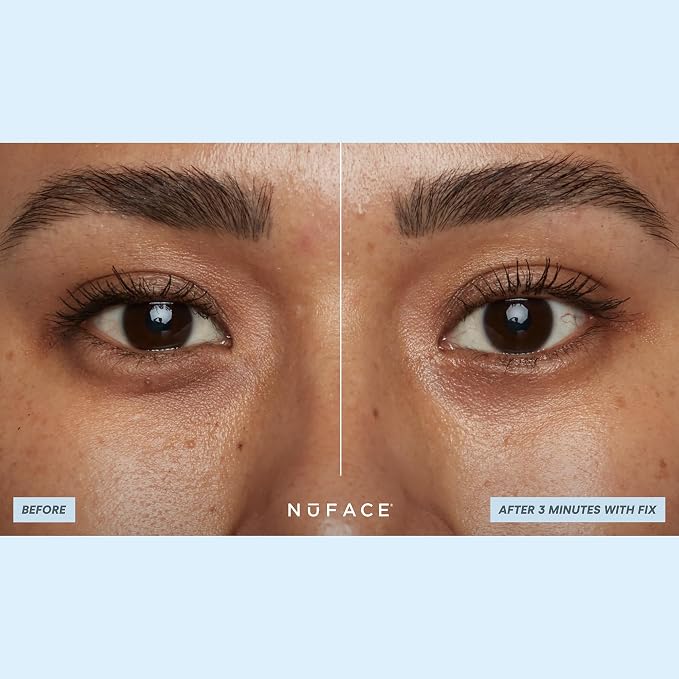 NuFACE IonPlex Hydra-Gel Power Under Eye Patches - Image 5