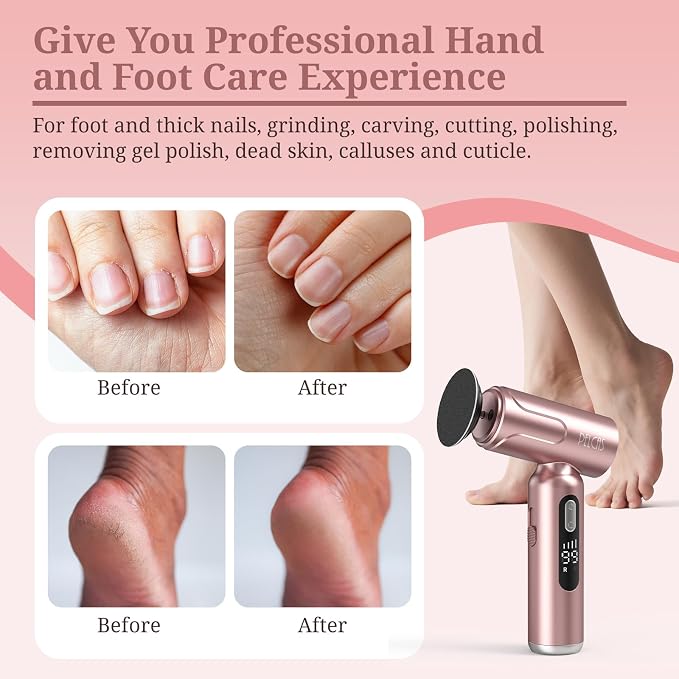 PELCAS Electric Foot Callus Remover - Image 2