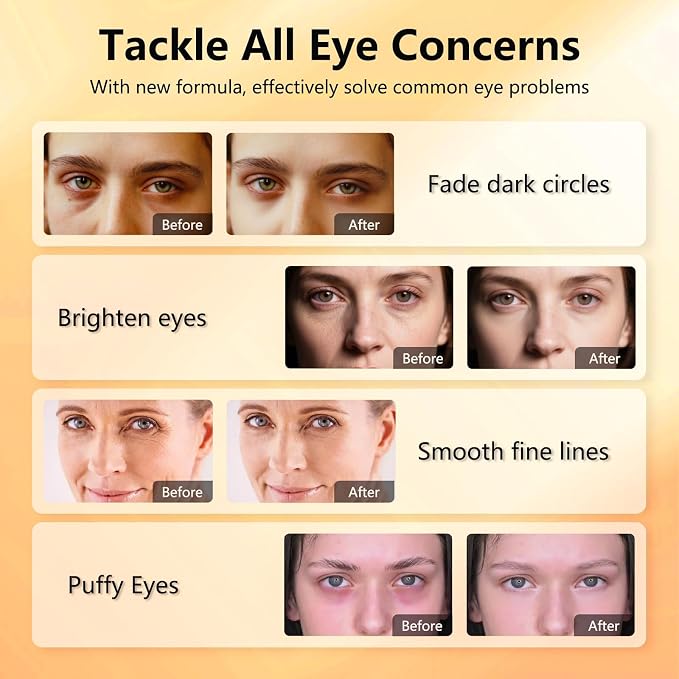 Under Eye Patches with Vitamin C & Caffeine 30 Pairs - Image 5