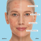 MAREE Glycolic Acid Pads – 200 Toner Pads - Image 7
