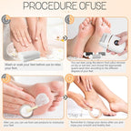 Automatic Callus Remover for Feet, Rechargeable Pedicure Tools for Feet - Image 4