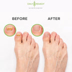 Tea Tree Oil Foot Soak with Epsom Salt - Image 6