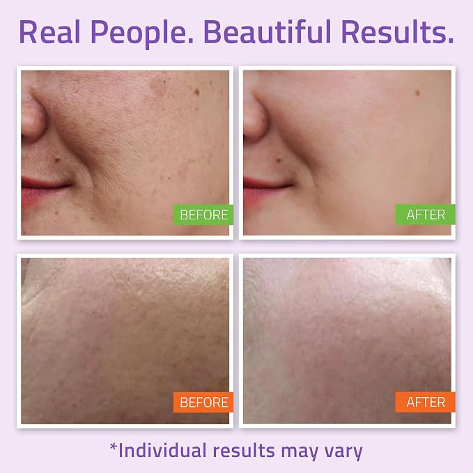 YEOUTH Skin Care Set: Hyaluronic Acid Serum - Image 4