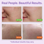 YEOUTH Skin Care Set: Hyaluronic Acid Serum - Image 4