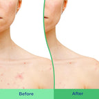 Differin Body Scrub with Salicylic Acid Acne Clearing Improves Tone and Texture - Image 4