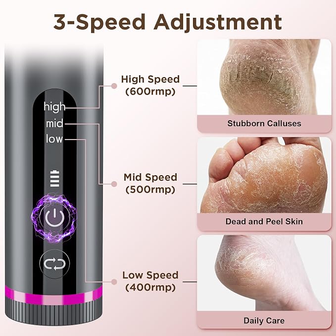 Electric Foot Callus Remover - Image 5