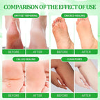 Pedicure Kit Foot Soak Set: Bubble Salt, Sugar Scrub, Massage Mask, Massage - Image 3