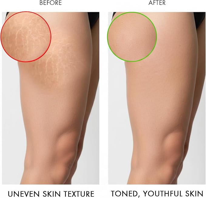 Majestic Pure Cellulite Massage Oil - Image 6