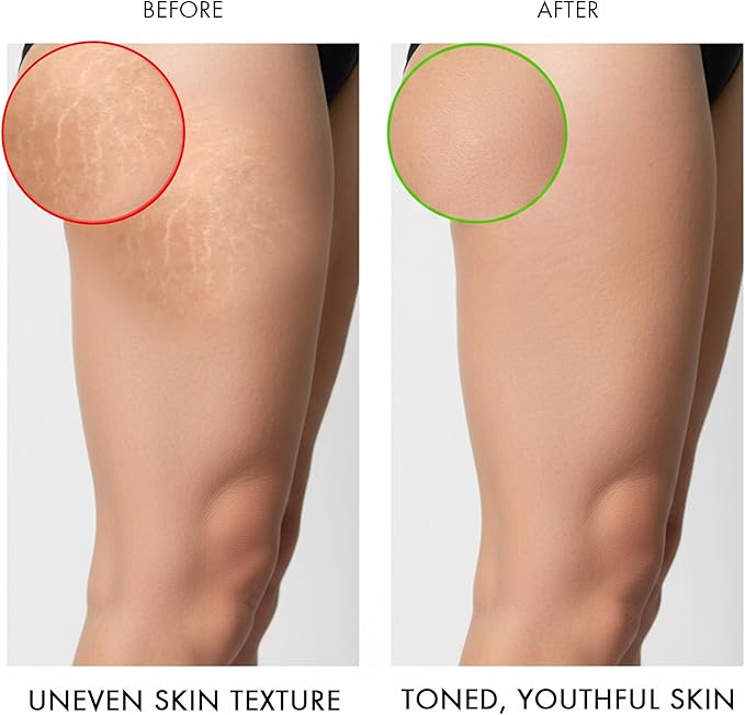Majestic Pure Cellulite Massage Oil - Image 5