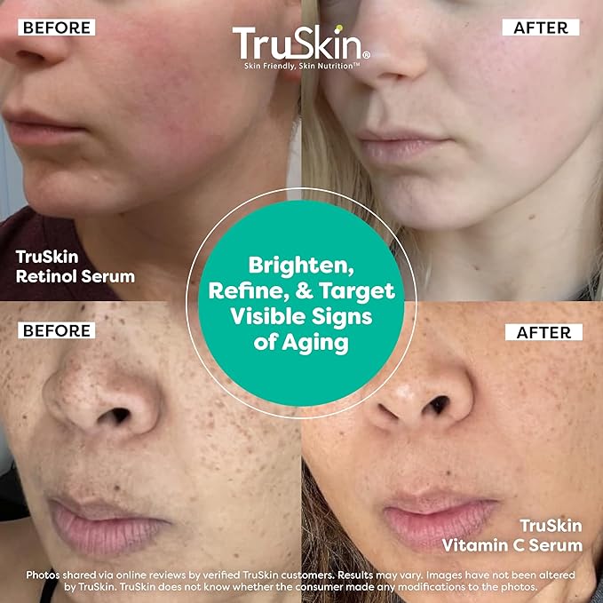 TruSkin Face Serum Duo - Image 4
