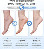 Rechargeable Electric Callus Remover - Image 3