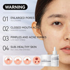 LANBENA 3-in-1 Blackhead Removal Set - Image 3