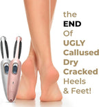 Powerful Electric Foot Callus Remover - Image 6