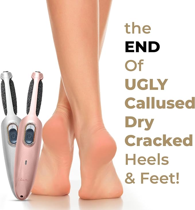 Powerful Electric Foot Callus Remover - Image 6