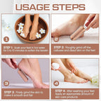 Moxweyeni 14 Pack Colossal Foot File Pedicure Tool Set - Image 4