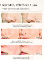 Rena Chris 3 pcs Silicone Face Scrubber, 3 in 1 Face Mask Applicator & Facial - Image 4