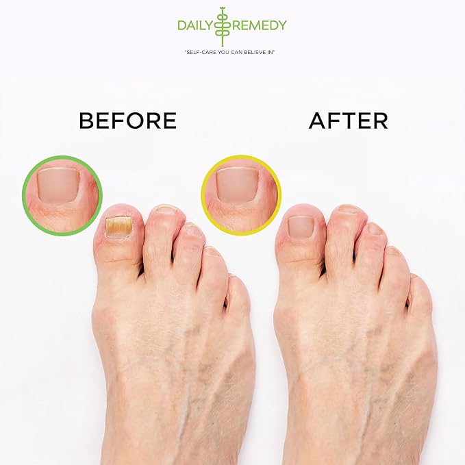 DAILY REMEDY 4-Pack Foot Soak Set - Image 6