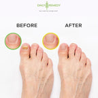 DAILY REMEDY 4-Pack Foot Soak Set - Image 6
