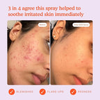 Tower 28 Jumbo SOS Daily Rescue Facial Spray - Image 7