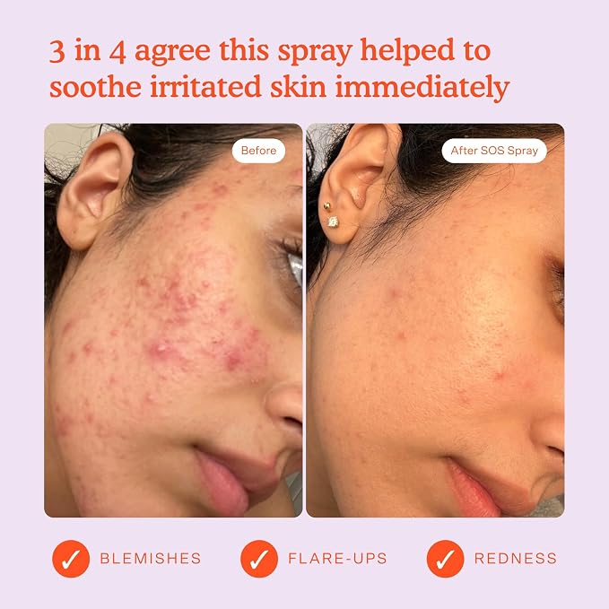 Tower 28 Jumbo SOS Daily Rescue Facial Spray - Image 7