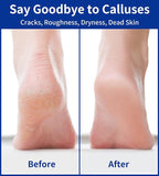 Nano Glass Foot File, Double-Sided Foot Callus Remover Feet Scrubber Hard & - Image 6