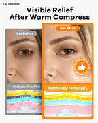 FACEMOON Heated Eye Mask for Dry Eyes: Electric Warm Compress for Blepharitis - Image 3