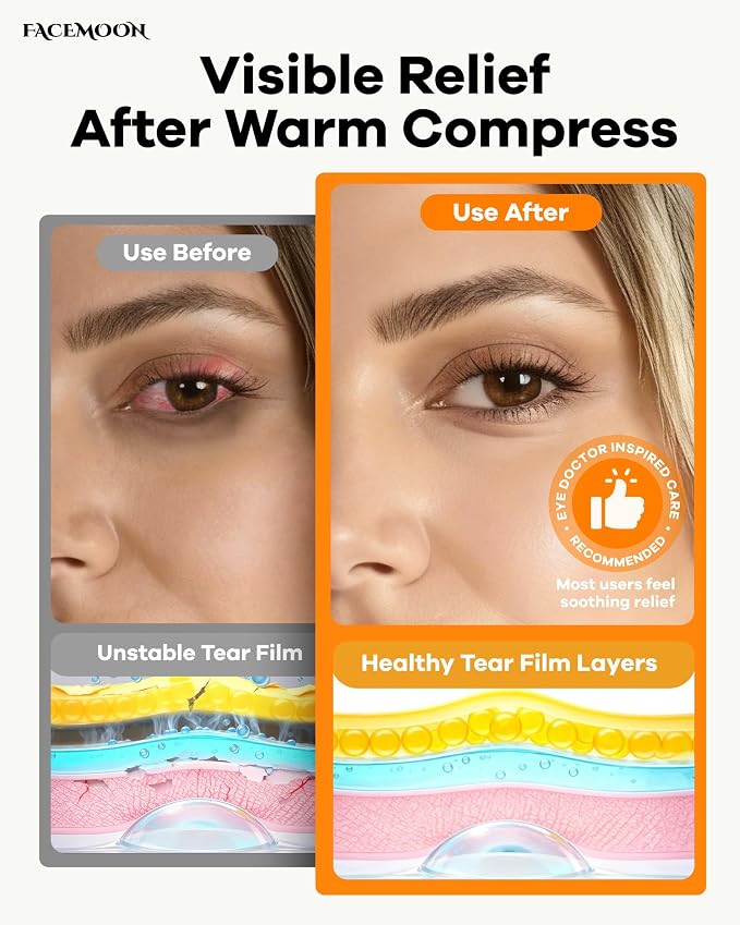 FACEMOON Heated Eye Mask for Dry Eyes: Electric Warm Compress for Blepharitis - Image 3