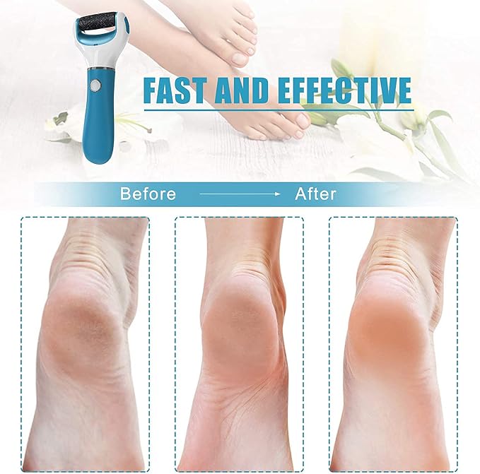 Electric Foot File Callus Remover Professional, 2-Speed Rechargeable Pedicure - Image 4