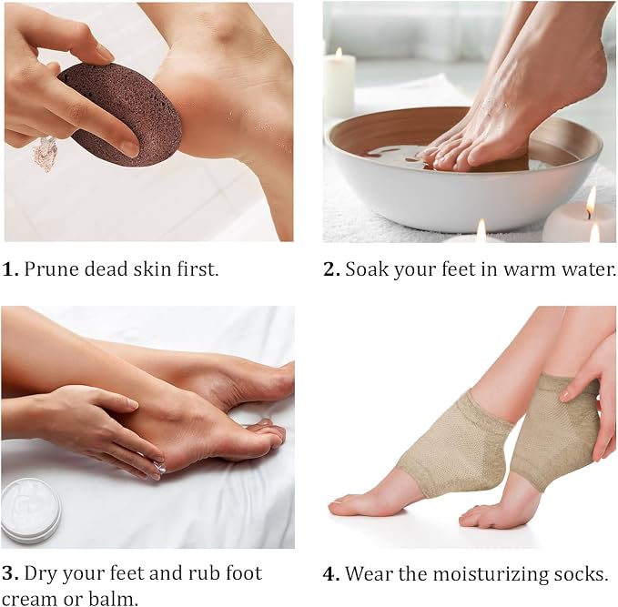 Pumice Stone for Feet Set - Image 5
