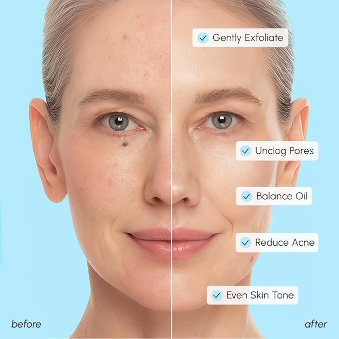 MAREE Glycolic Acid Pads & 2% Salicylic Acid – Toner Pads - Image 6