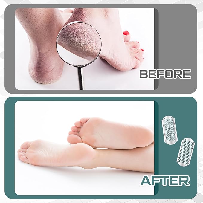 Moxweyeni 7 Pack Colossal Foot File Pedicure Tools Sets - Image 4