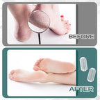 Moxweyeni 7 Pack Colossal Foot File Pedicure Tools Sets - Image 4