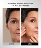 INIA Red Light Therapy Mask for Face, Glow Wireless LED Face Mask Light Therapy - Image 8