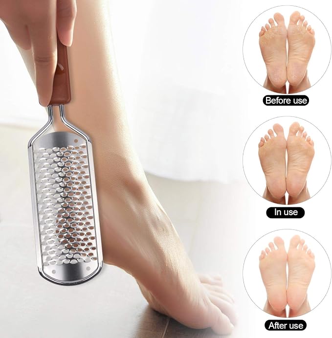 2 Pieces Colossal Foot Rasp Foot Files Callus Remover Foot Scrubber, Stainless - Image 4