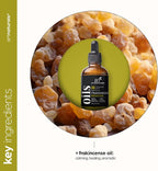 artnaturals Frankincense Essential Oil - Image 4