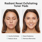 MAREE Glycolic Acid Resurfacing Pads - Image 5