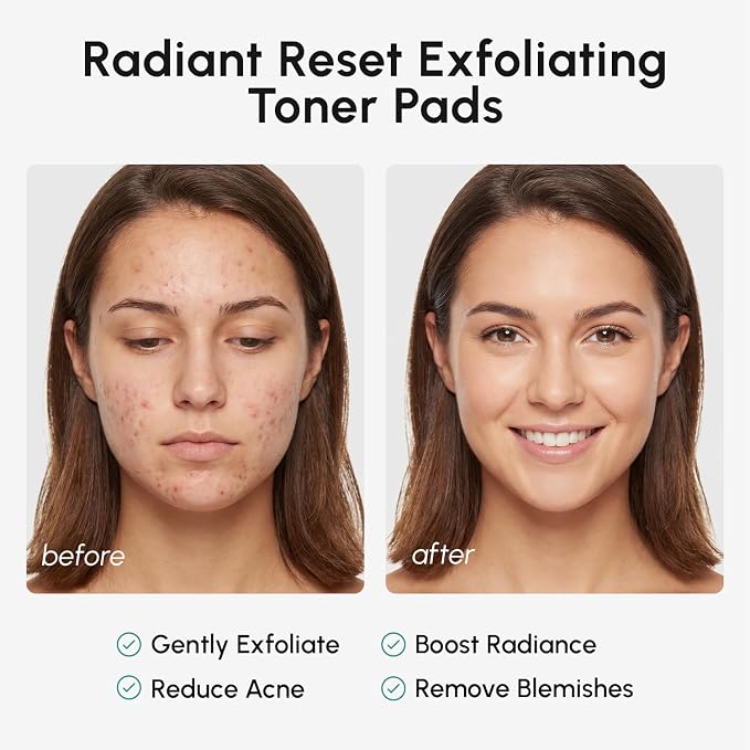 MAREE Glycolic Acid Resurfacing Pads - Image 5