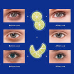 ZNÖCUETÖD Gel Ice Pack Reusable Cooling Eye Pads and Under Eye Patches - Image 7