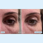 NuFACE IonPlex Hydra-Gel Power Under Eye Patches - Image 6