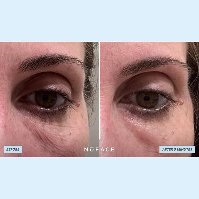 NuFACE IonPlex Hydra-Gel Power Under Eye Patches - Image 6
