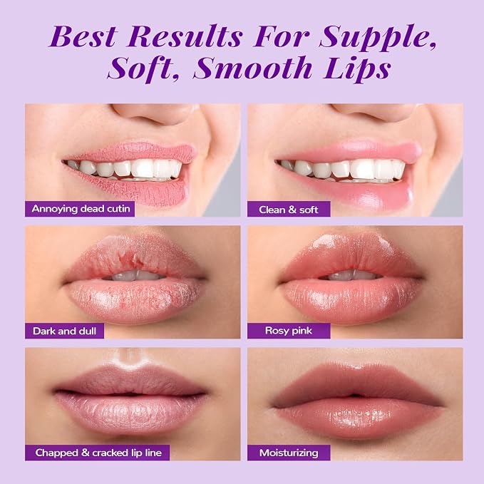 ANAI RUI Lip Therapy Set, Lip Scrub & Lip Mask, Overnight Hydrating Lip - Image 7