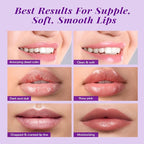 ANAI RUI Lip Therapy Set, Lip Scrub & Lip Mask, Overnight Hydrating Lip - Image 7