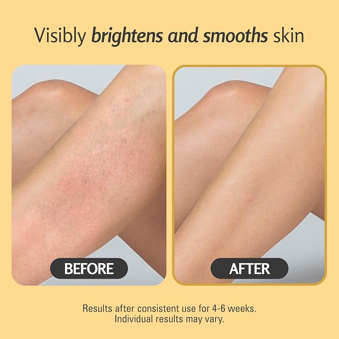Exfoliating Turmeric Scrub and Skin Exfoliator - Image 8