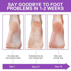 ALIVER Foot Peel Mask 3 Pack, Exfoliator Peel Off Calluses Dead Skin Callus - Image 7