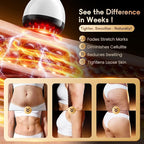 Lymphatic Drainage Massager & Anti Cellulite Massage Tool, Helps Reduce Stretch - Image 6