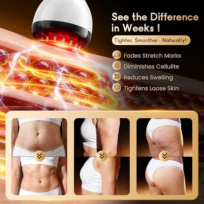 Lymphatic Drainage Massager & Anti Cellulite Massage Tool, Helps Reduce Stretch - Image 6
