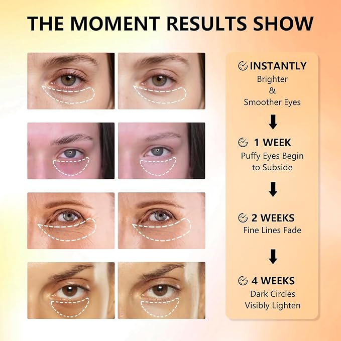 Under Eye Patches with Vitamin C & Caffeine 30 Pairs - Image 7