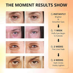 Under Eye Patches with Vitamin C & Caffeine 30 Pairs - Image 7